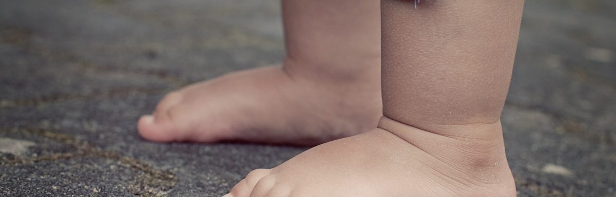 Swollen Feet causes and symptoms