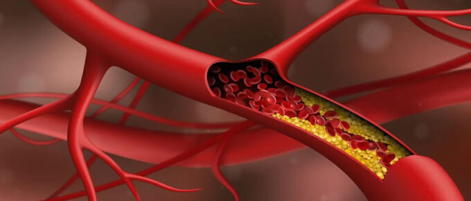 cholesterol in the blood